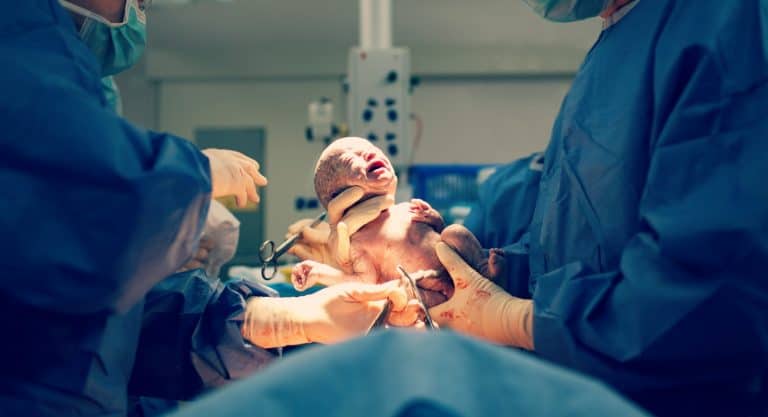 tu bebé nace por cesárea