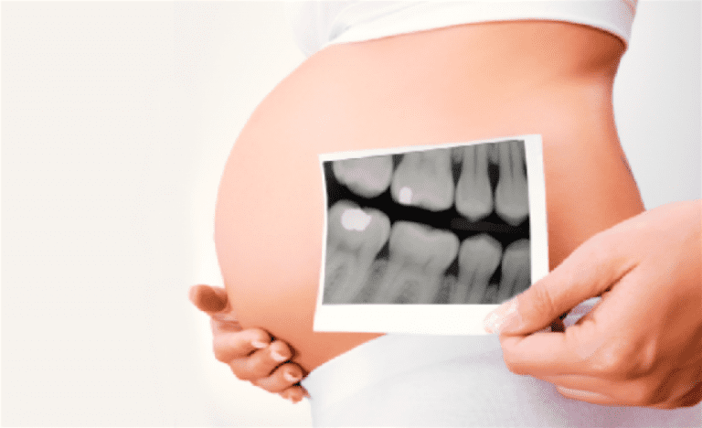 embarazada-dentista-3
