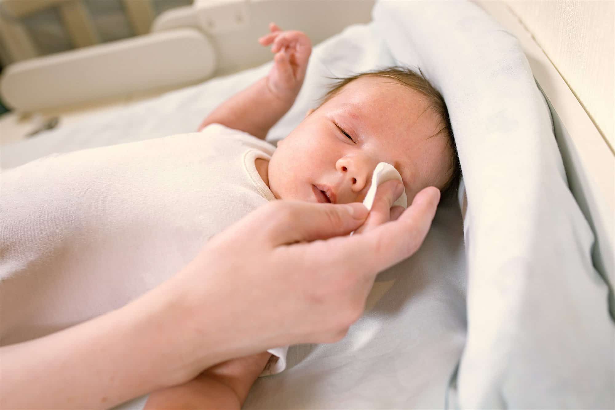 Cómo tratar la conjuntivitis en el recién nacido