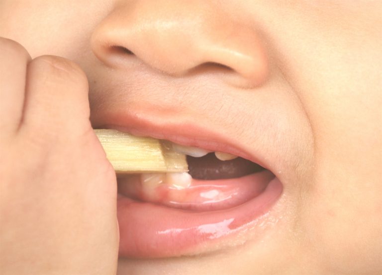 niño al dentista por primera vez 