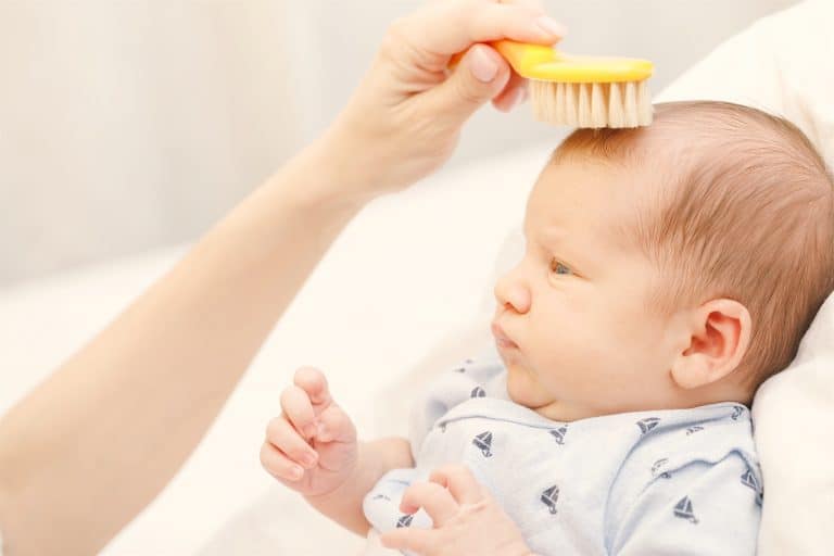 Qué es la costra láctea del bebé?, Consultas Frecuentes