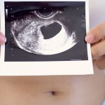 ¿Por qué se produce un embarazo anembrionario?