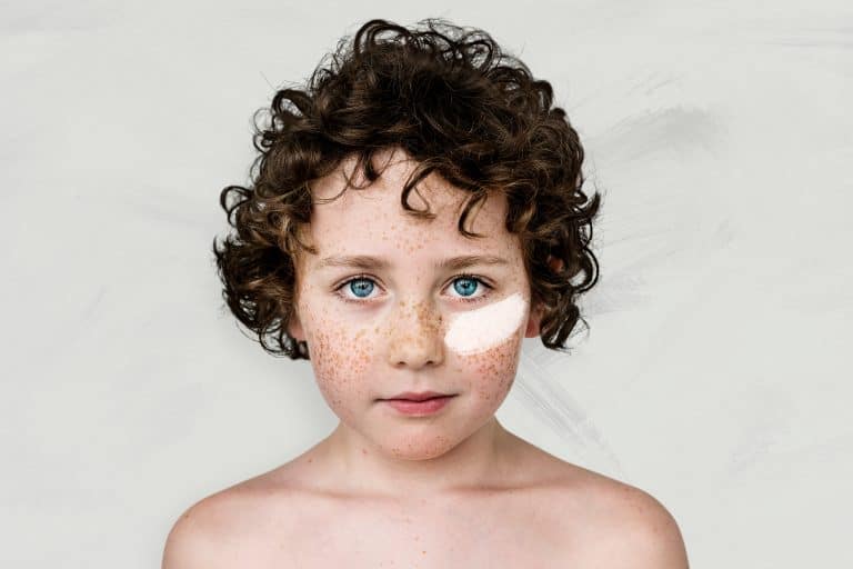 ¿Por qué mi hijo tiene pecas? - ¿Por qué salen las pecas?