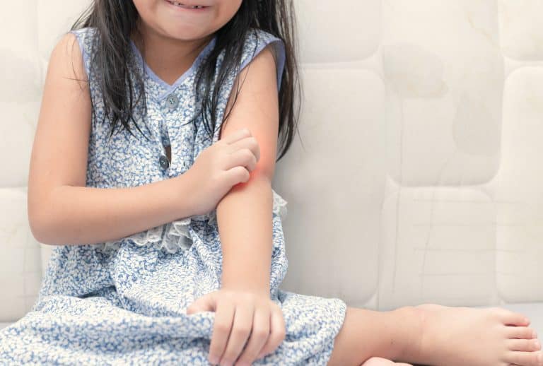 Psoriasis en los niños: Causas, síntomas y tratamiento