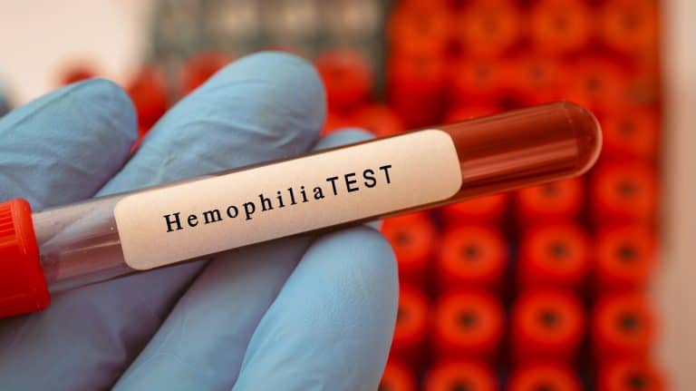 Hemofilia en la infancia, ¿qué debemos saber?