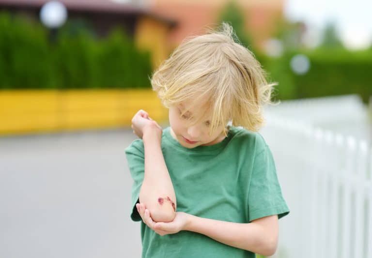 Hemofilia en la infancia, ¿qué debemos saber?