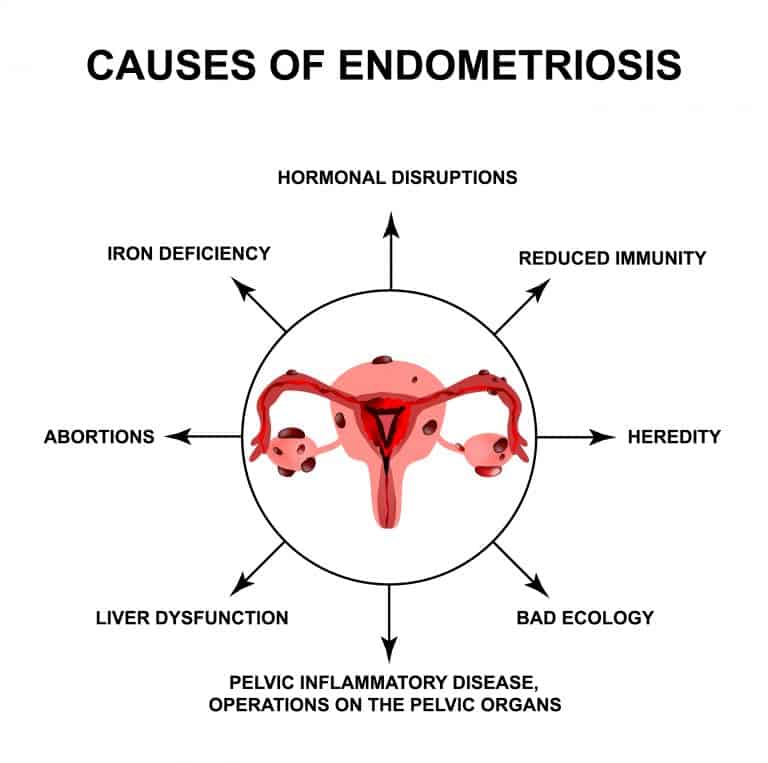 Día Mundial de la Endometriosis - Entrevista con mujeres afectadas