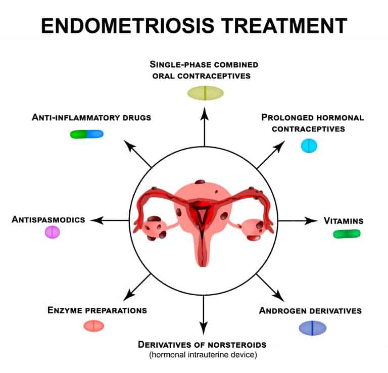 afectadas por endometriosis