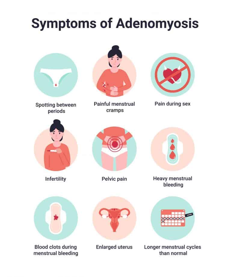 afectadas por endometriosis