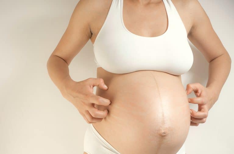 ¿Por qué sale y cuándo se quita la línea alba en el embarazo?