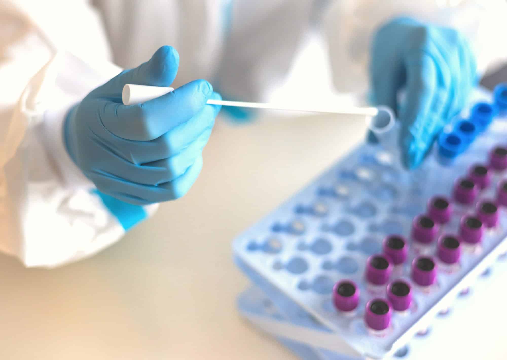 Empresas españolas lanzan PCR para detectar la viruela del mono