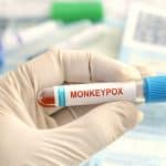Stanford lanza su test para detectar la viruela del mono