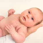 Acné neonatal: Qué es, tratamiento y duración