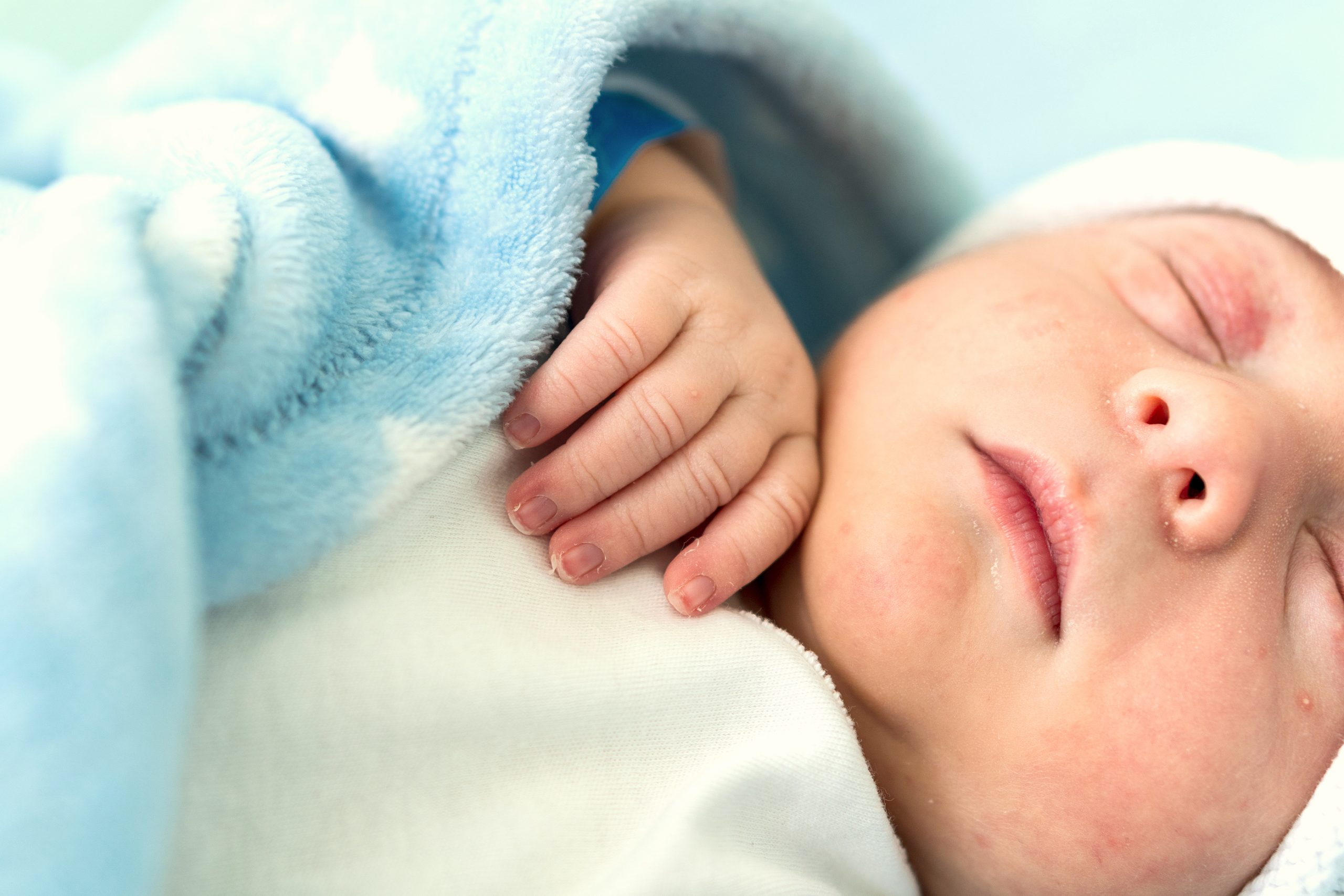 ¿Qué causa la enfermedad hemolítica del recién nacido?