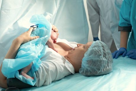 Las secuelas de una cesárea en la salud del bebé