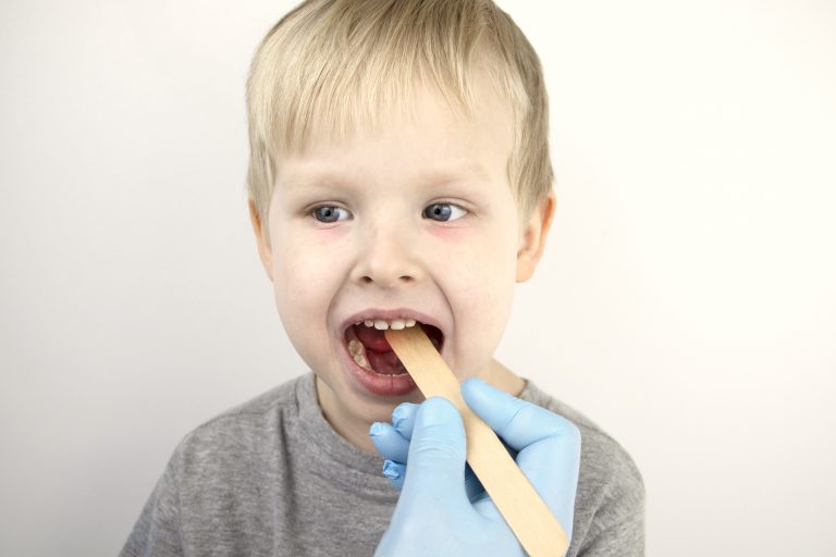 ¿Cómo tratar la faringitis en niños?