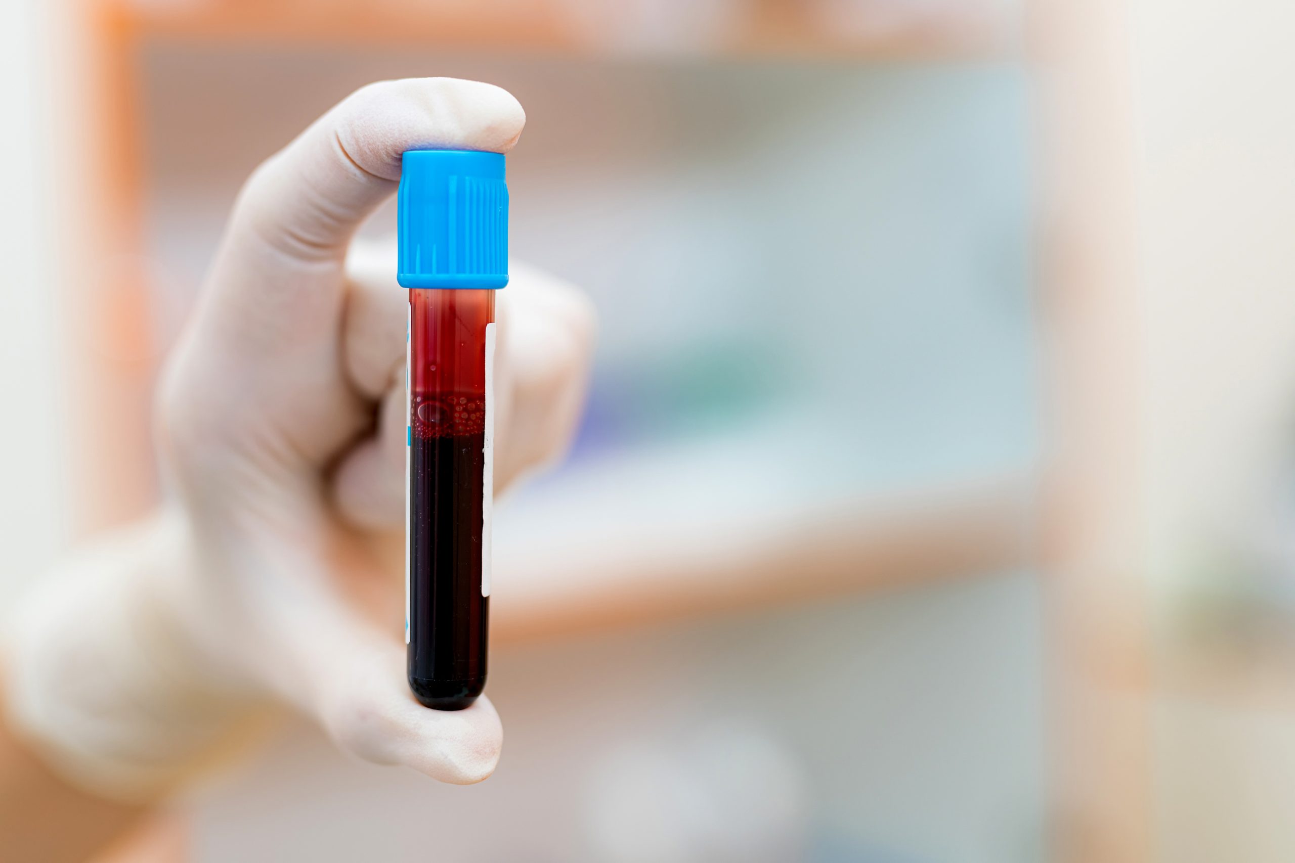 En el analisis de sangre sale el tiempo de embarazo 2025