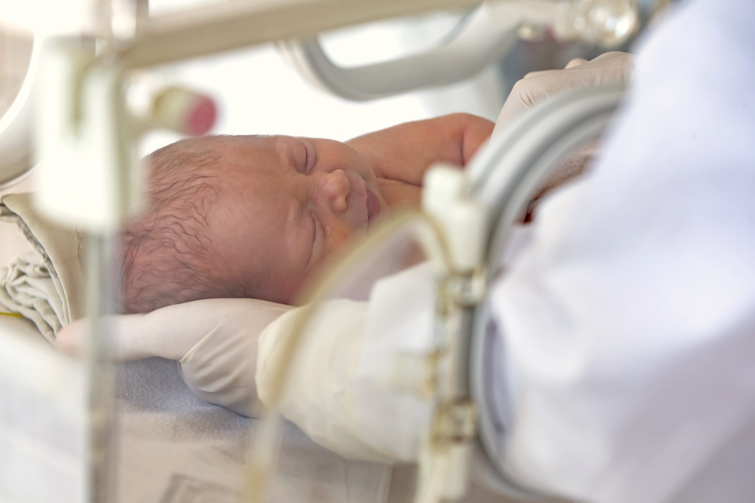 Uno de cada 10 bebés que nacen en el mundo es prematuro