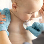 Meningococos: ¿Cómo empieza la meningitis en niños?