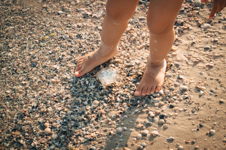 ¿Qué se debe hacer en caso de picadura de medusa?