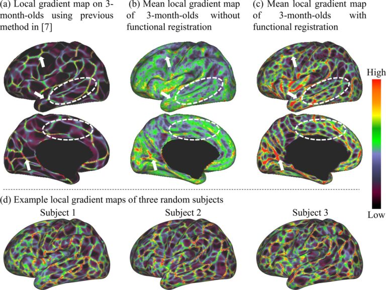 Neurodesarrollo infantil: Primeros mapas completos