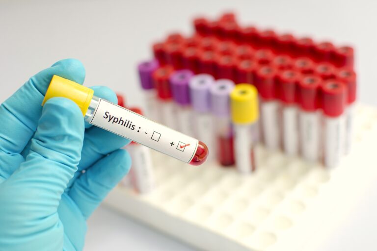 Sífilis congénita: ¿Qué pasa si un bebé nace con sífilis?