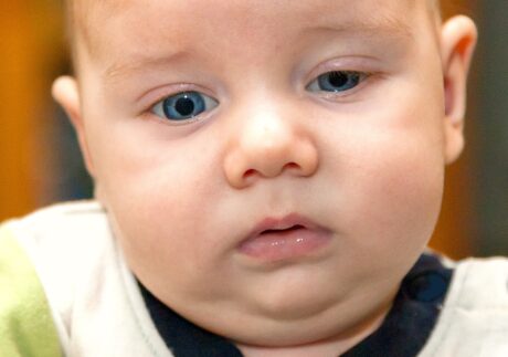 Párpado caído en bebé: ¿Qué causa el párpado caído?